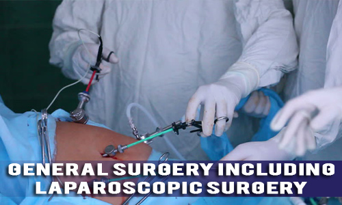 Laparoscopy